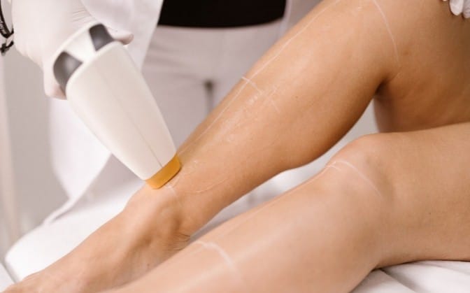 Laser ontharing behandeling